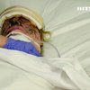 У лікарні Дніпра врятували постраждалу від ракетного удару по Костянтинівці